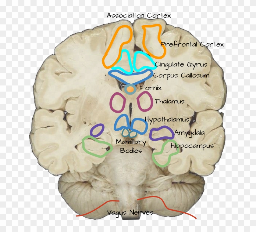 Amygdala - Corpus Callosum And Cingulate Gyrus Clipart #4135976