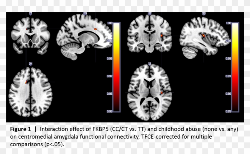Figure1 , Png Download - Computed Tomography Clipart