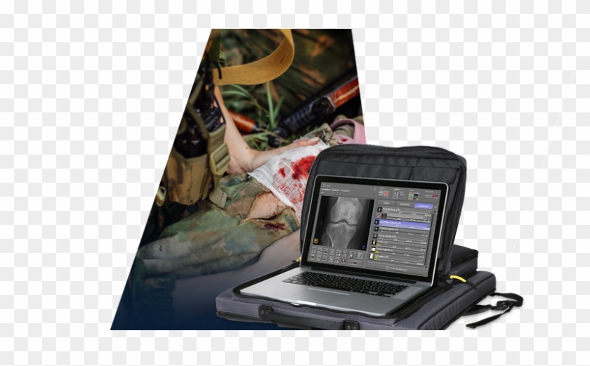 Leonardo Nano - Portable Medical Device Military Clipart #4138847