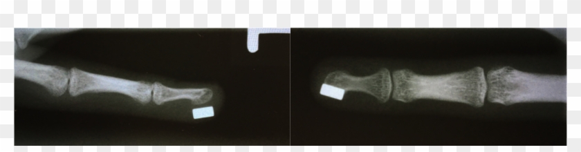 Magnetic Sensory Augmentation - Medical Radiography Clipart