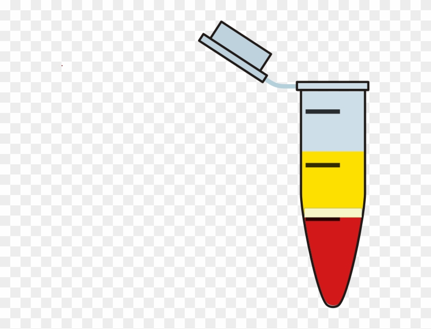 Small - Eppendorf Tube Clipart #4161672