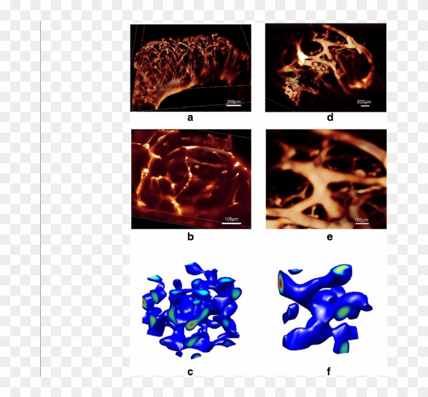 Alterations Of The 3d Self-organized Vmc Multicellular - Flame Clipart