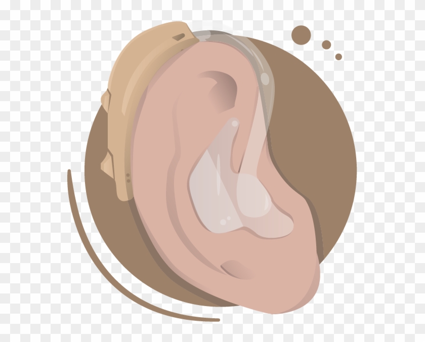 Hearing Aids Today Tend To Be Designed Much More Discreetly - Illustration Clipart