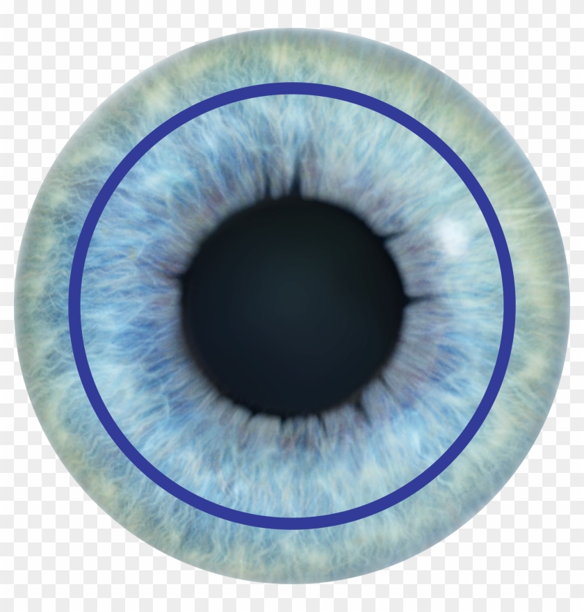 It Is The Healing Time - Surface Ablation Laser Treatment Clipart