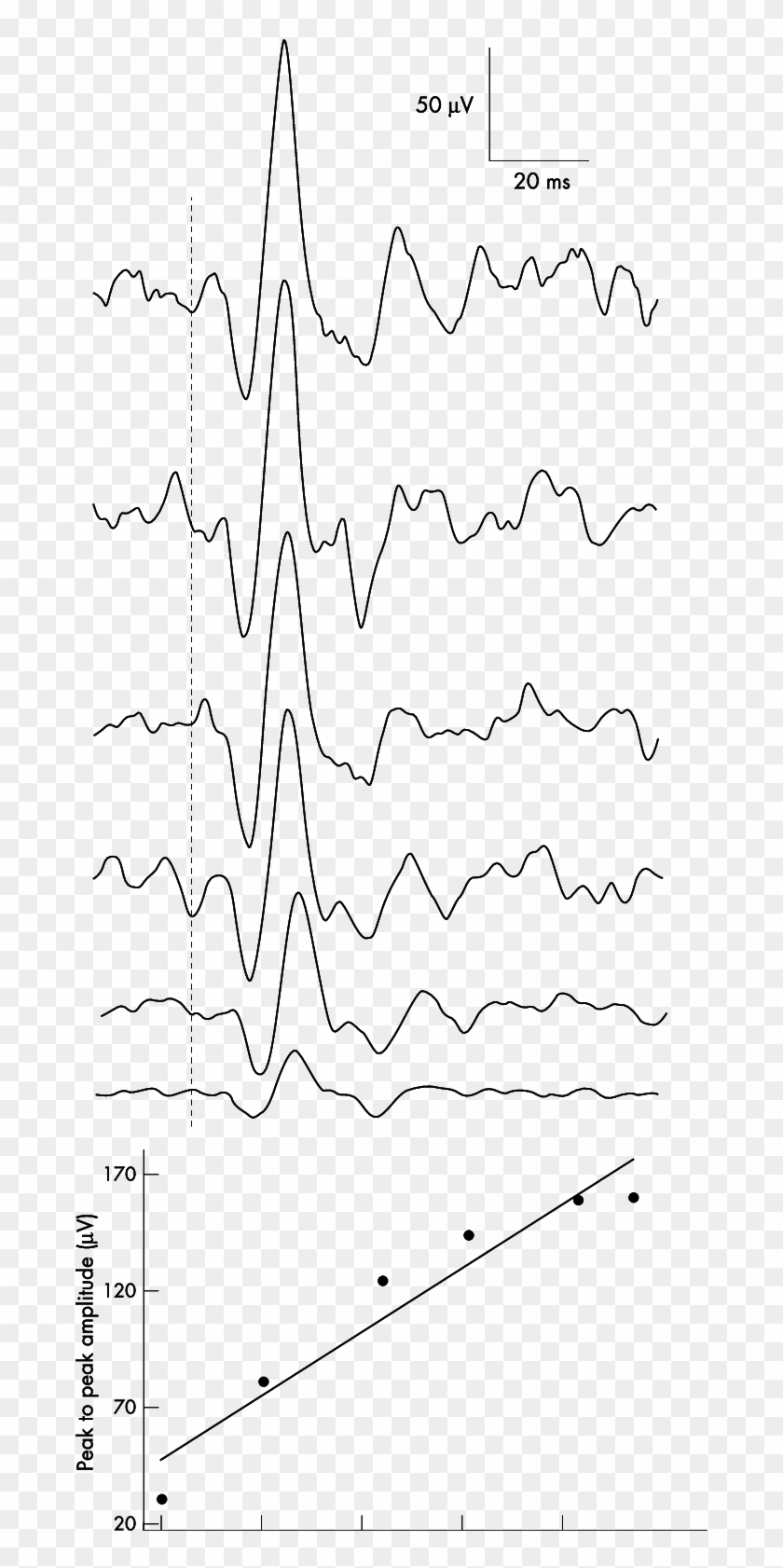 The Effect Of Background Electromyographic Activity - Line Art Clipart