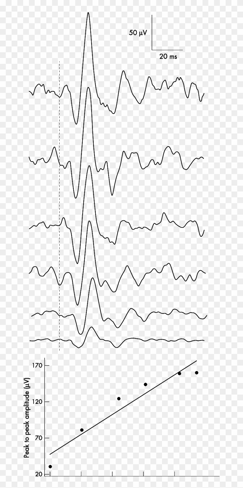 The Effect Of Background Electromyographic Activity - Line Art Clipart #4233565