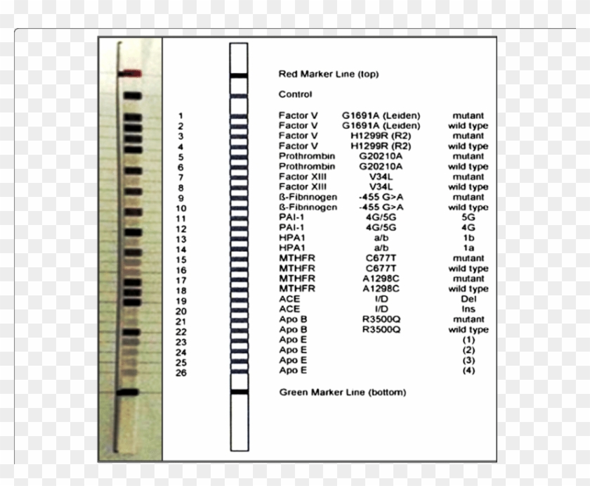 Design Of Cvd Strip Assay Test Used In The Current - Cvd Strip Assay Clipart #4238207