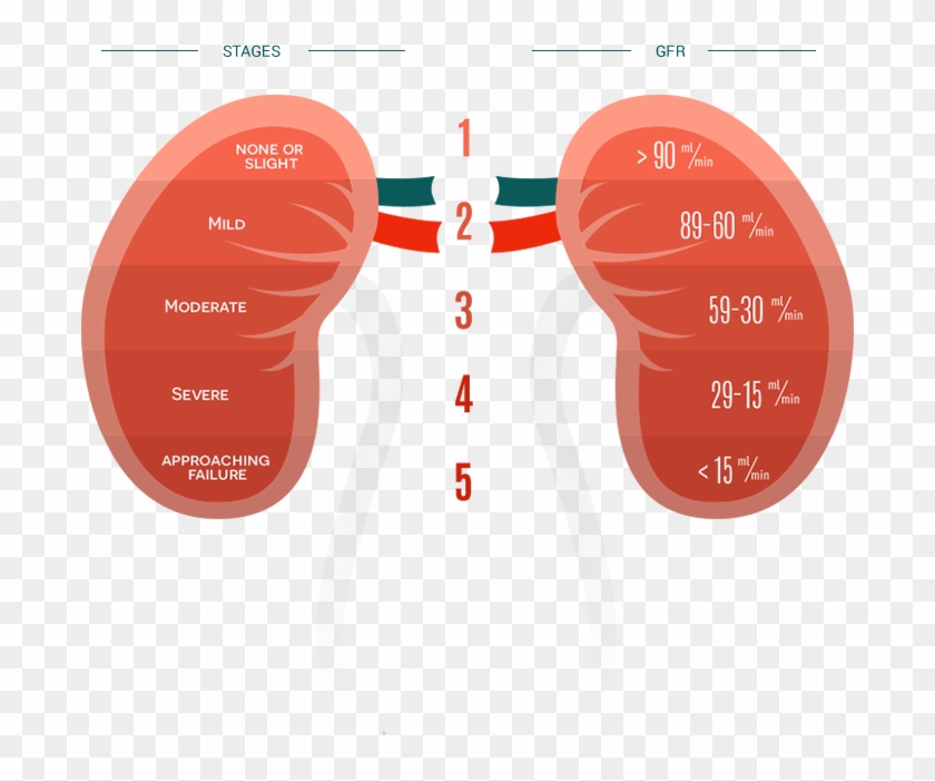 Kidneys - Doença Renal Cronica Estagio 5 Clipart