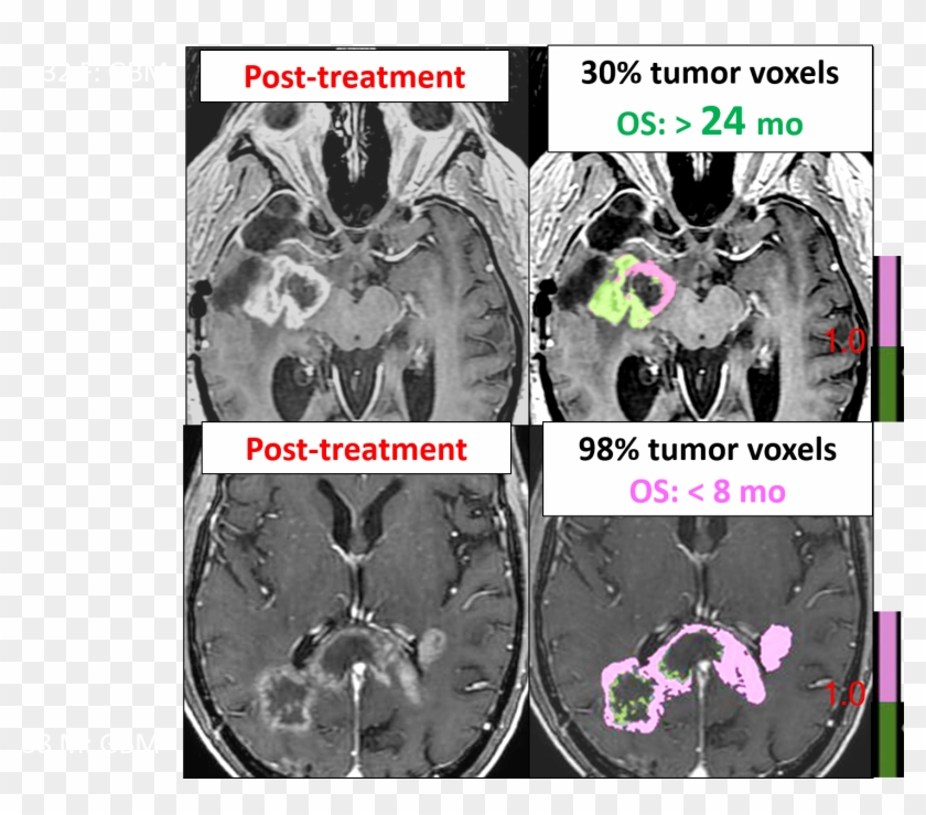 Get In Contact - Computed Tomography Clipart #4241787