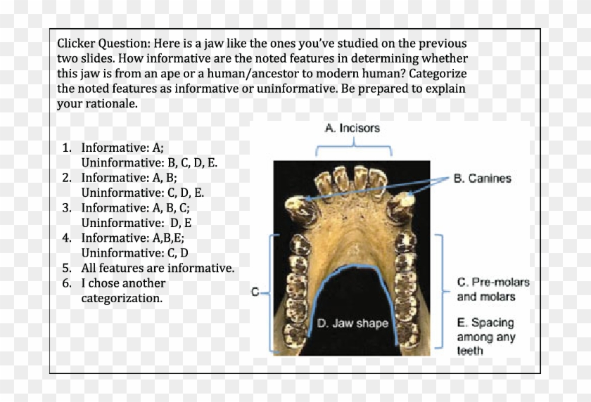 Jaw Analysis Question From A Case Study On Human Evolution - Strepsirhine Mandibular Dental Arcade Clipart #4247702