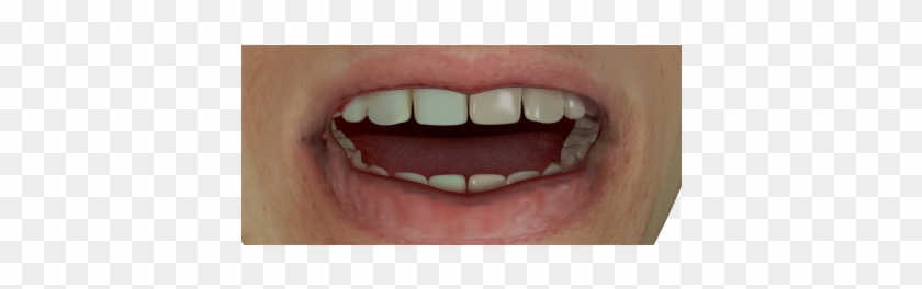 Teeth Test6 960×540 130 Kb - Tongue Clipart