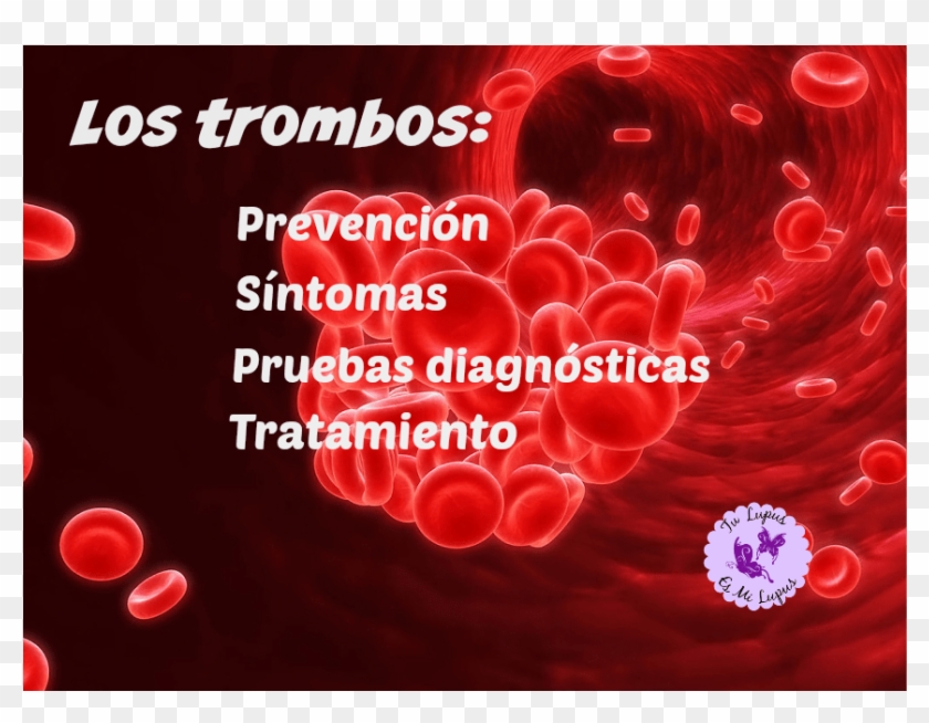 Trombos Y Trombosis - Blood Clot Clipart