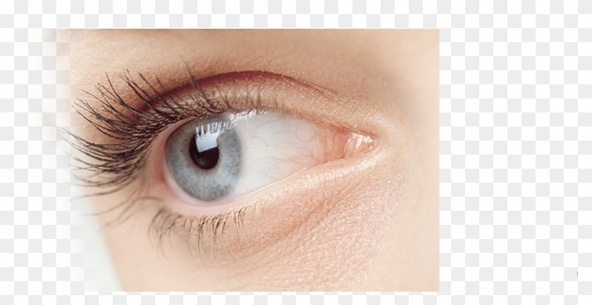 Monovision Lasik Eye Surgery - Under Eye Area Clipart #430220