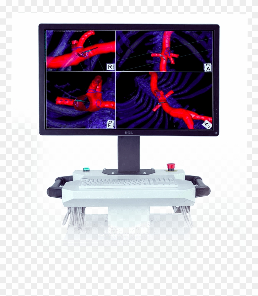 Latest News - Led-backlit Lcd Display Clipart #4308206