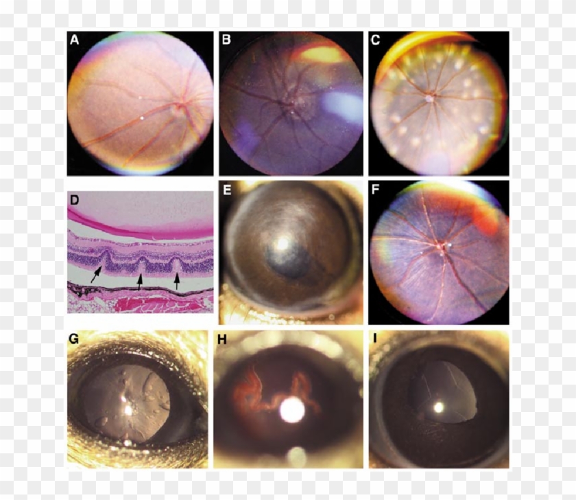 Clinical Phenotypes Of Mutant Lines - Outer Space Clipart