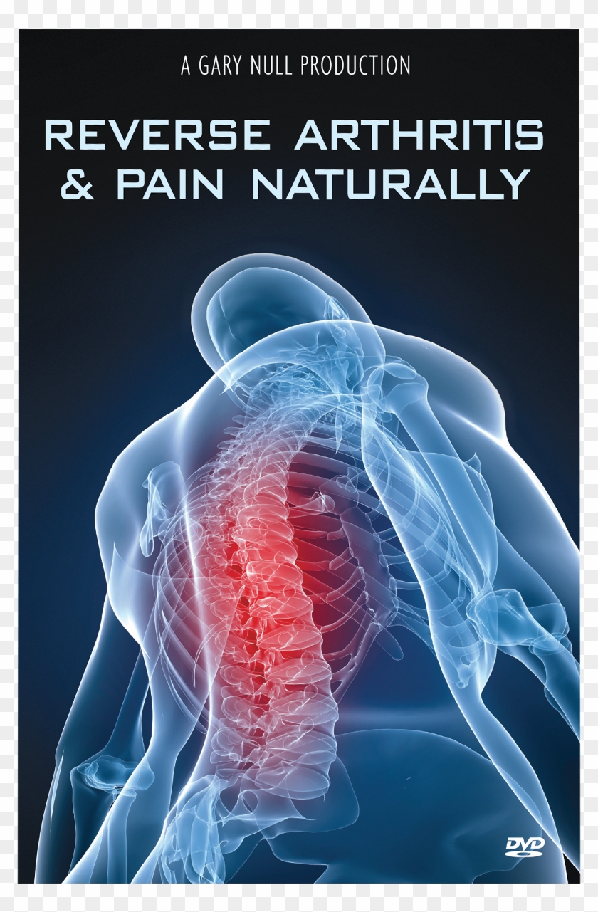 Reverse Arthritis & Pain Naturally Dvd - Chiropractic Care Clipart