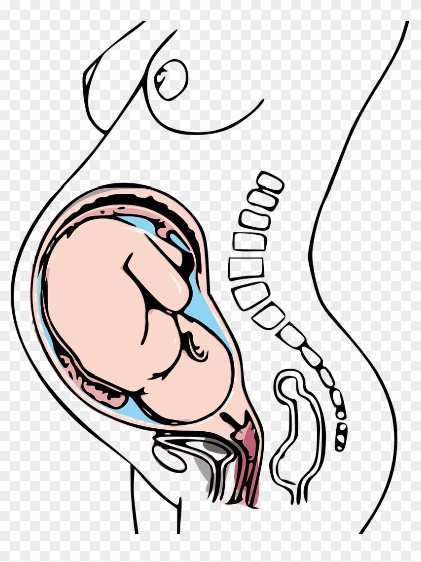 Low Dose Aspirin Can Help With Pregnancy Clipart #4348172