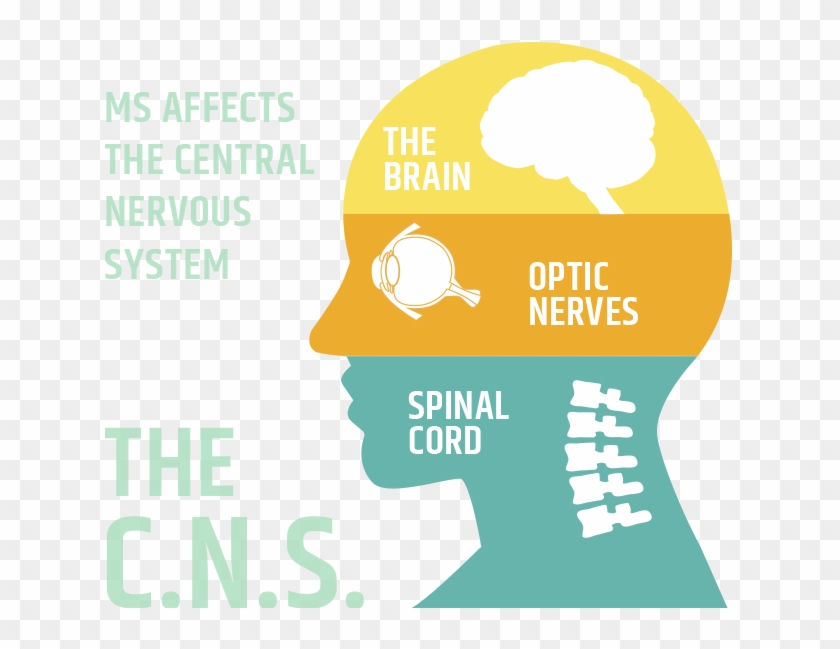 Centeral Nervous System - Multiple Sclerosis Central Nervous System Clipart #4365447