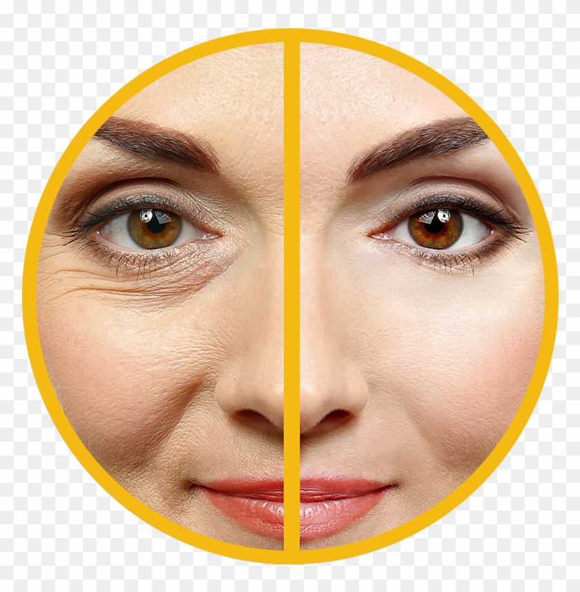 Size - - Fine Lines And Wrinkles Clipart #4399039