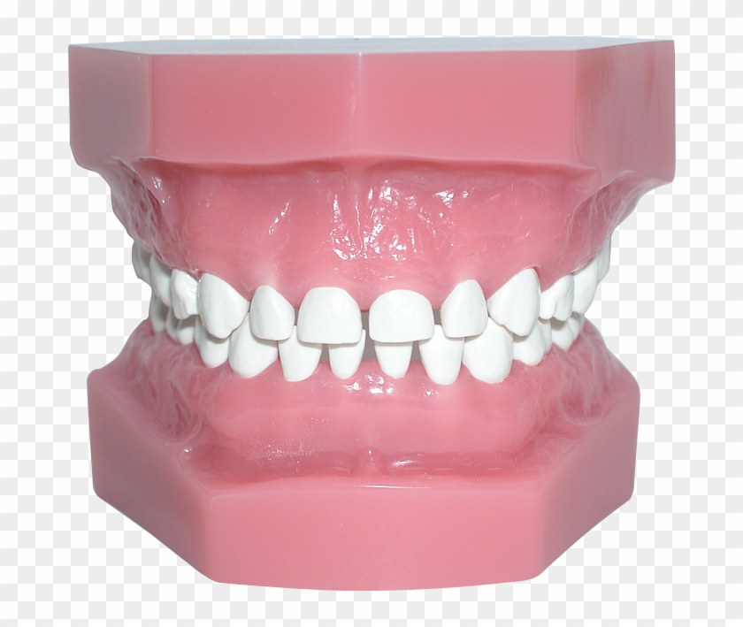Pedo Model With High Heat Teeth - Teeth Model Png Clipart #446679