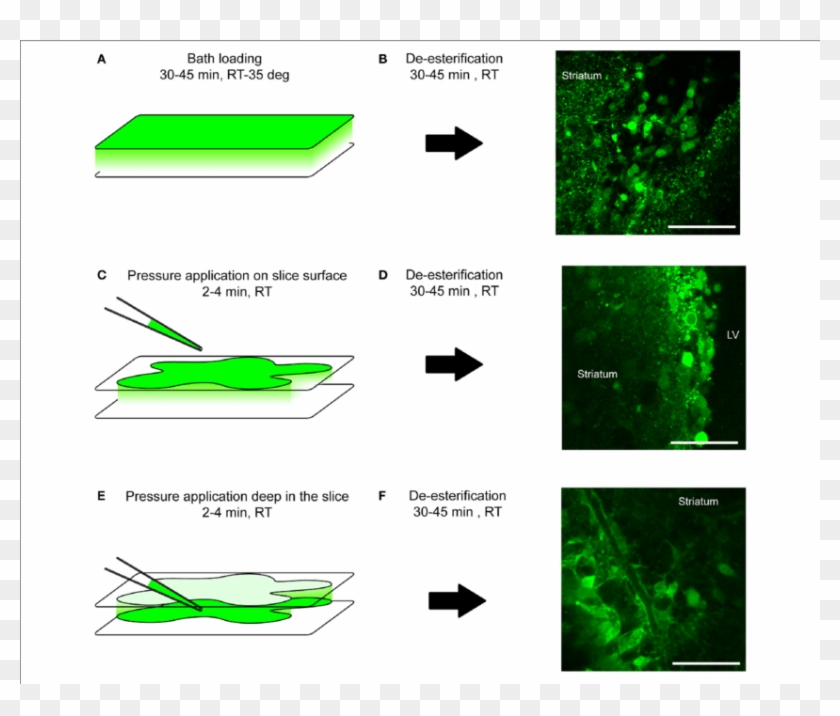 Loading Protocol Of Calcium Indicator Dyes - Brain Slice Calcium Imaging Clipart #449454