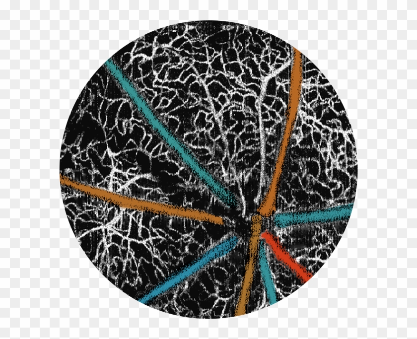 Original Image After - Circle Clipart