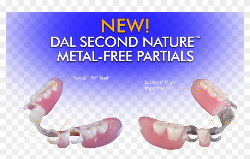 Dal Second Nature Partial Dentures Leverage Innovative - Tongue Clipart #4451554