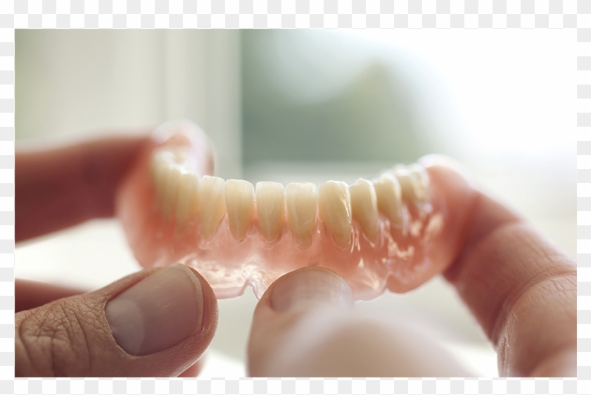 Beautifully Crafted Dentures - Material Used In Production Of Denture Clipart