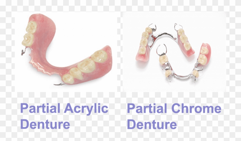 What Are Immediate Dentures - Homenature Clipart #4452004