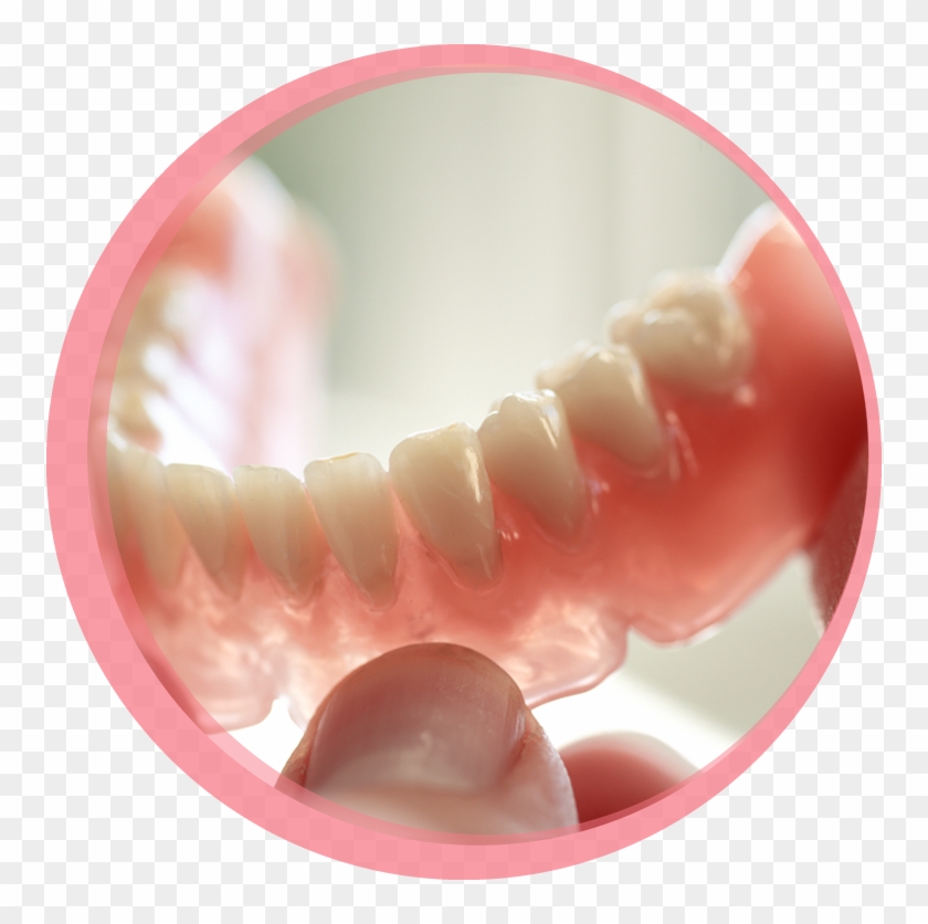 You May Experience An Adjustment Period With Your First - Horseshoe Upper Denture Without Implants Clipart #4452859