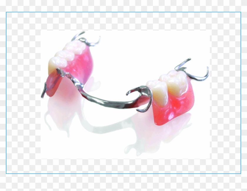 What - Lower Cobalt Chrome Denture Clipart