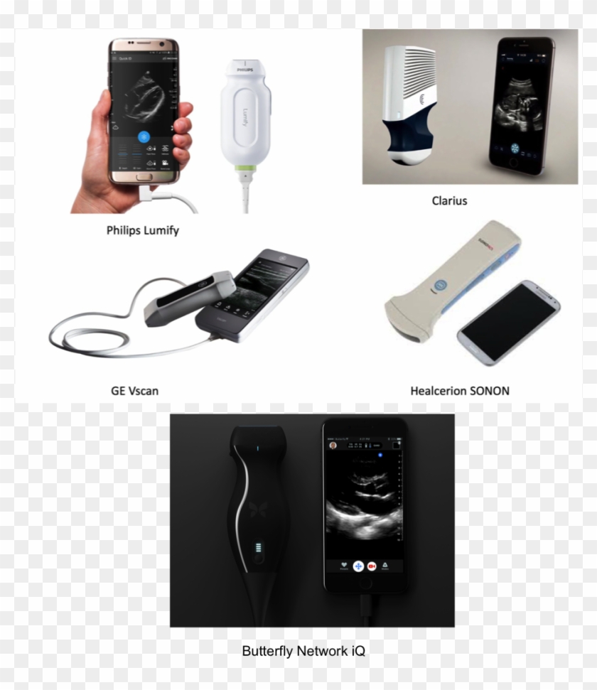 Ultrasound On A Chip Supercharged With Ai - Ai Ultrasound Clipart #4456994