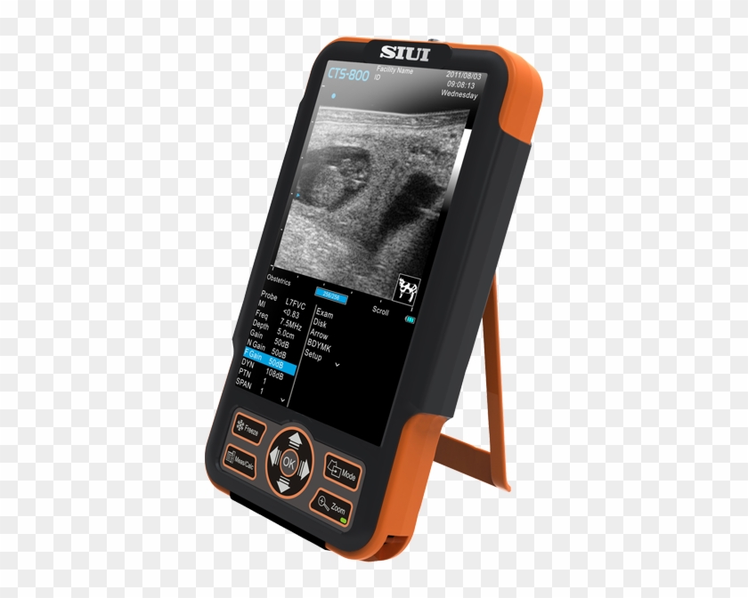 Palm-size Veterinary Ultrasound System - Siui Cts 800 Clipart
