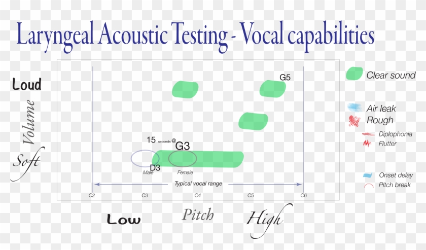 Diagramming A Loud Sound Production Task - Human Voice Clipart #4466682