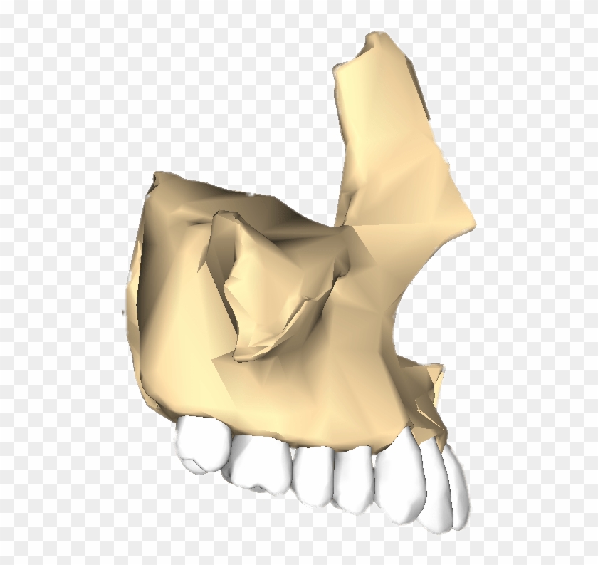 Download - Hueso Maxilar Png Clipart #4519376