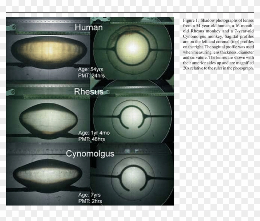 Shadow Photograph Of A 42year-old Lens Removed From - Circle Clipart #4539923