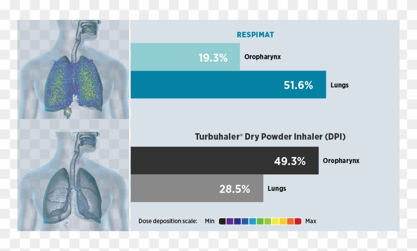 Respimat Delivers Medication Efficiently And Effectively - Spiriva Respimat Deposition Clipart
