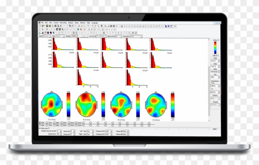Macbook-wineeg Analytics Screen - Software Clipart #4569146