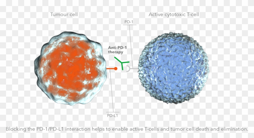 Non Small Cell Lung Cancer - Sphere Clipart #4613644