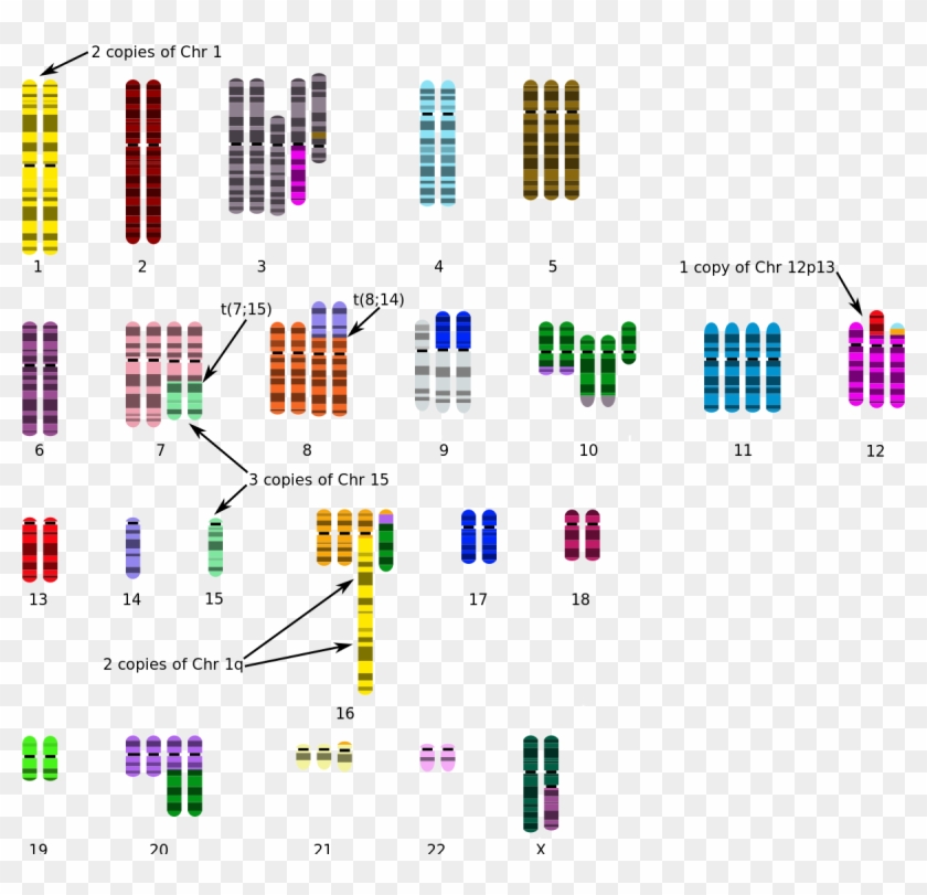 T-47d - Breast Cancer Cell Karyotype Clipart