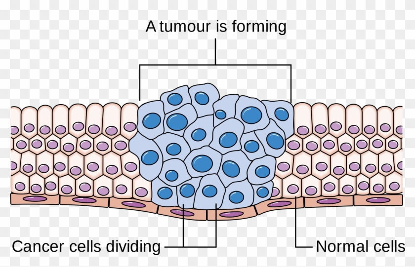 Mitosis Cancer Clipart