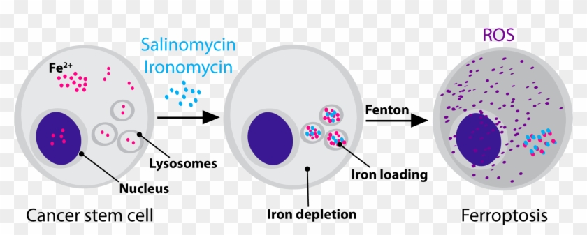 Salinomycin Targets Mesenchymal Cancer Cells By Sequestering - Lysosomes Cancer Cell Clipart #4614562