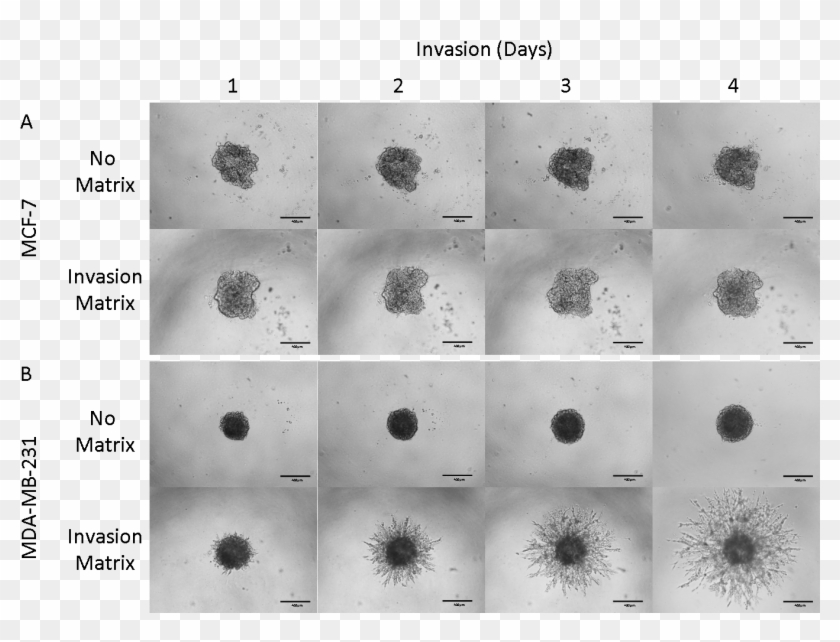 Mda Mb 231 Spheroids Clipart