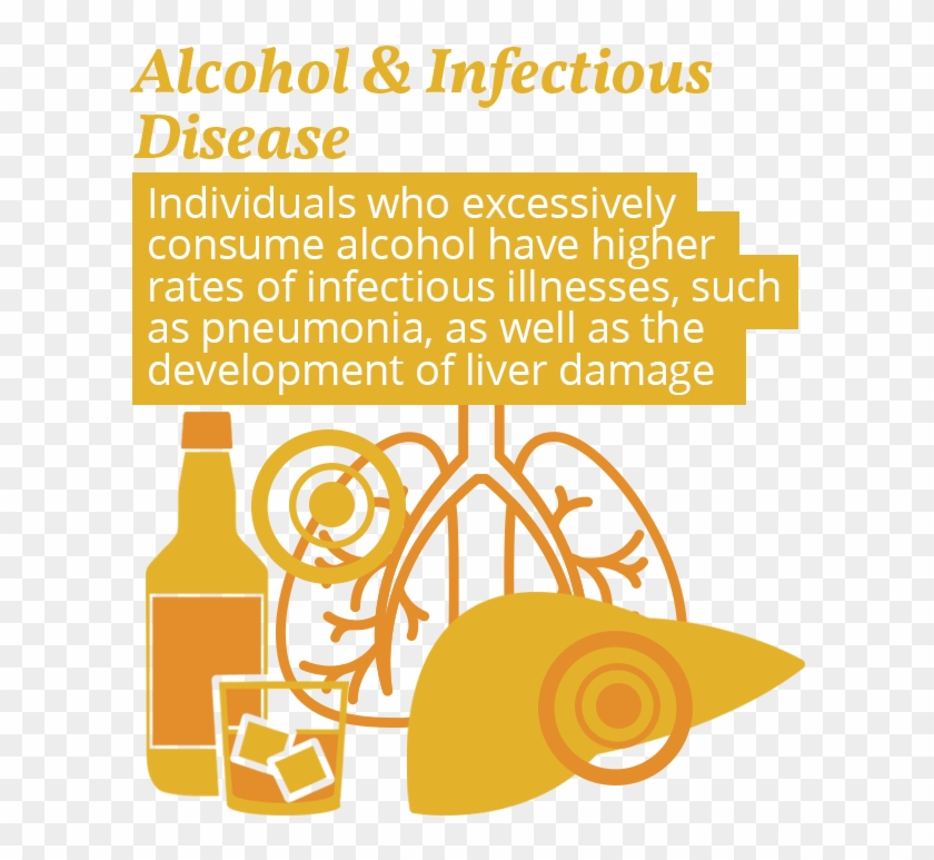Infectious Diseases From Drugs - Infectious Disease Alcohol Clipart #4667176