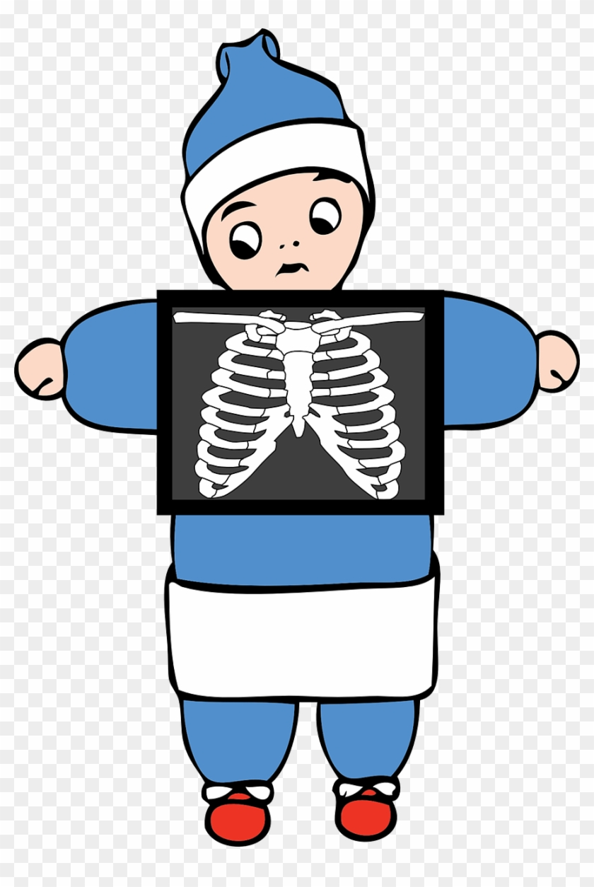 X-ray Anatomy Bone Medical Png Image - X Ray Clipart Transparent Png #4667823