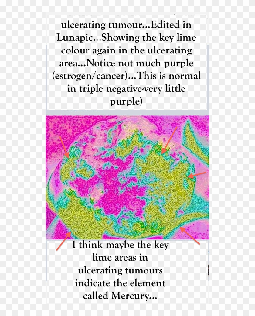 Triple- - Sterling College Clipart #4682205