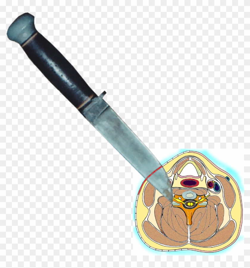 In These Cases, The Knife Hits The Vertebrae After - Cross Section Of The Neck Clipart