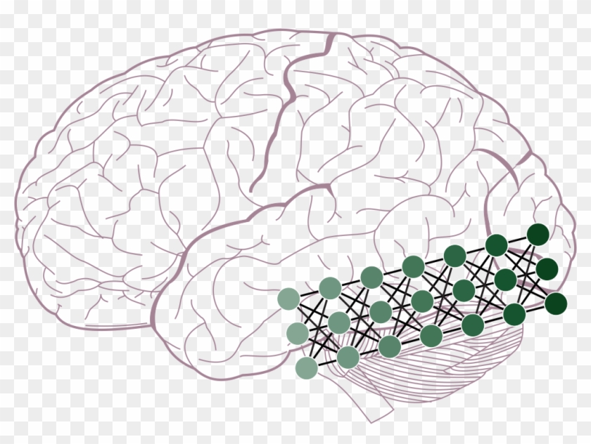 Figure 2b From Guest And Love - Lobes Of The Brain Clipart #4732990