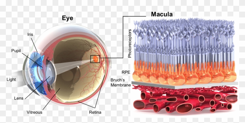 Amd Has Three Forms - Armd Eye Clipart
