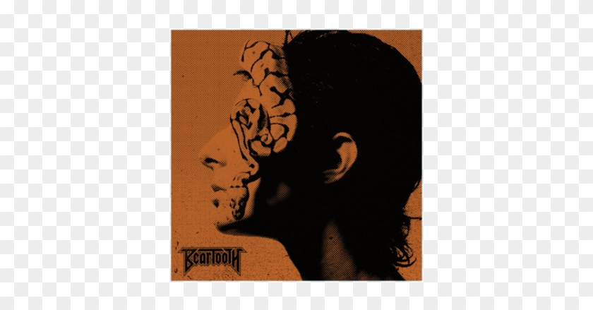 Beartooth Disease Clipart